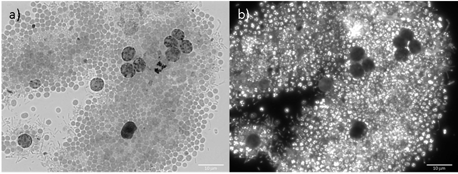 Microscopic image of a photosynthetic mixed culture currently operated by iBET and fed with real fermented wastewater